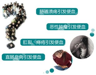 便血的原因
